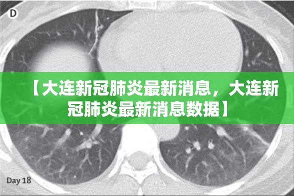 【大连新冠肺炎最新消息,大连新冠肺炎最新消息数据】 【大连新冠肺炎最新消息,大连新冠肺炎最新消息数据】