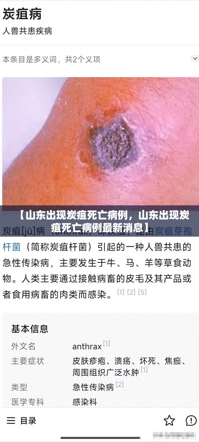 【山东出现炭疽死亡病例，山东出现炭疽死亡病例最新消息】