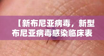 【新布尼亚病毒，新型布尼亚病毒感染临床表现】