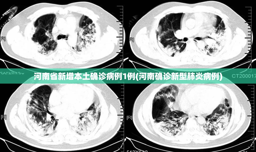 河南省新增本土确诊病例1例(河南确诊新型肺炎病例)
