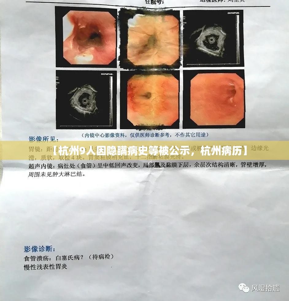【杭州9人因隐瞒病史等被公示，杭州病历】
