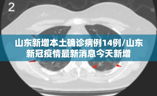 山东新增本土确诊病例14例/山东新冠疫情最新消息今天新增