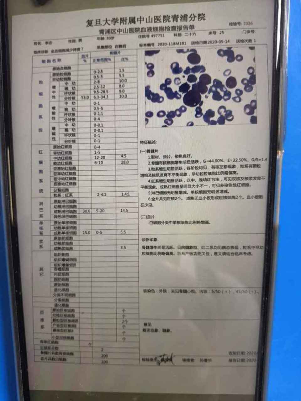 西安:未来几天新增病例仍可能较多/西安慢病不再新增骨髓增生异常综合征