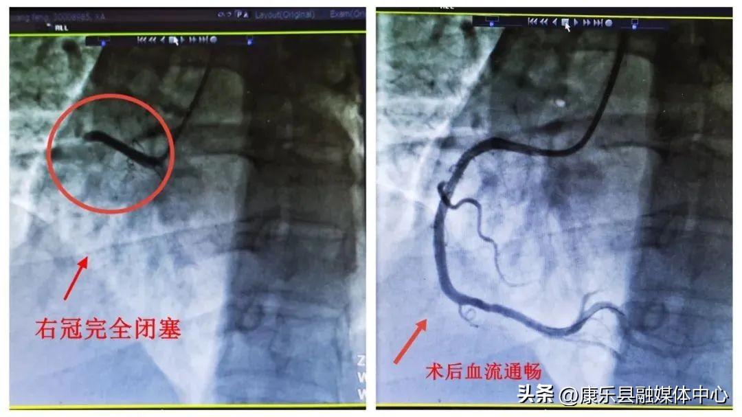 【北京顺义发现1例阳性人员，北京顺义新增多个高风险区】