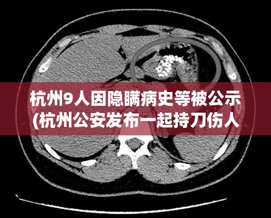 杭州9人因隐瞒病史等被公示(杭州公安发布一起持刀伤人警情)