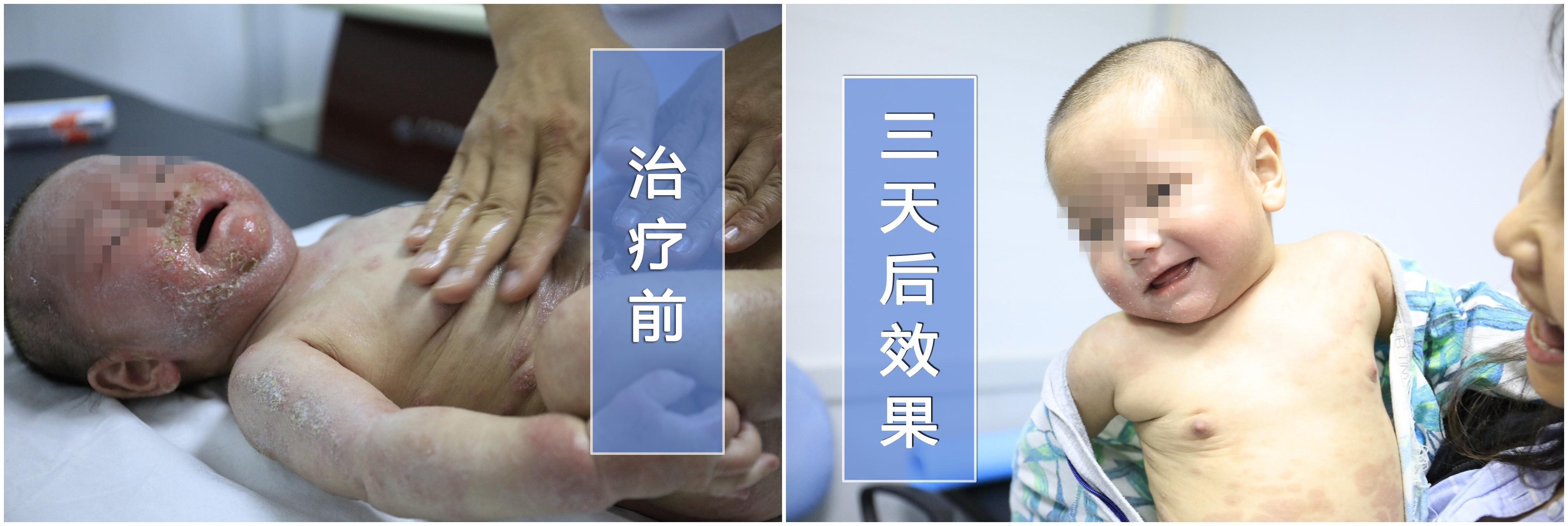 北京顺义新增1例无症状/北京顺义最新消息 北京顺义新增1例无症状/北京顺义最新消息