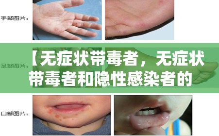 【无症状带毒者，无症状带毒者和隐性感染者的区别】
